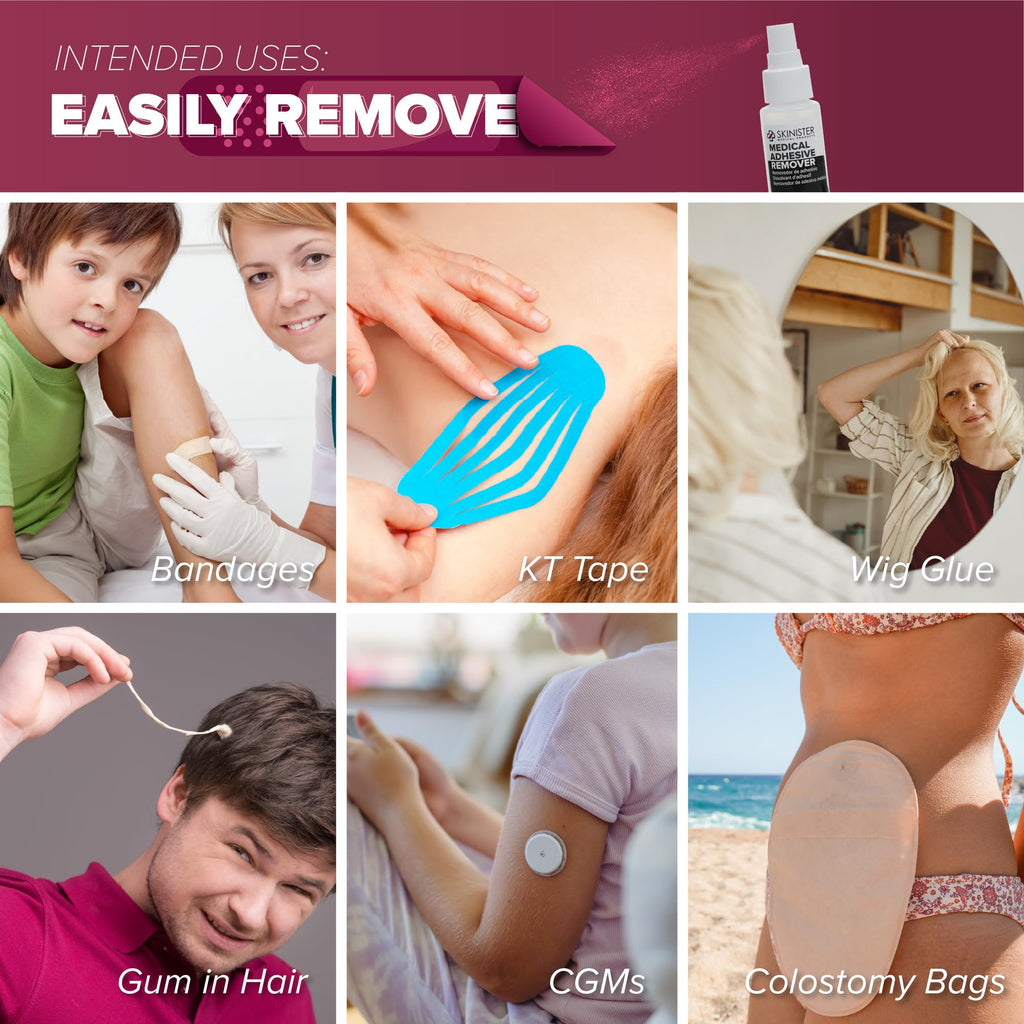 Adhesive Remover Wipes 50 Dry Wipes + 2oz Spray Solution T564