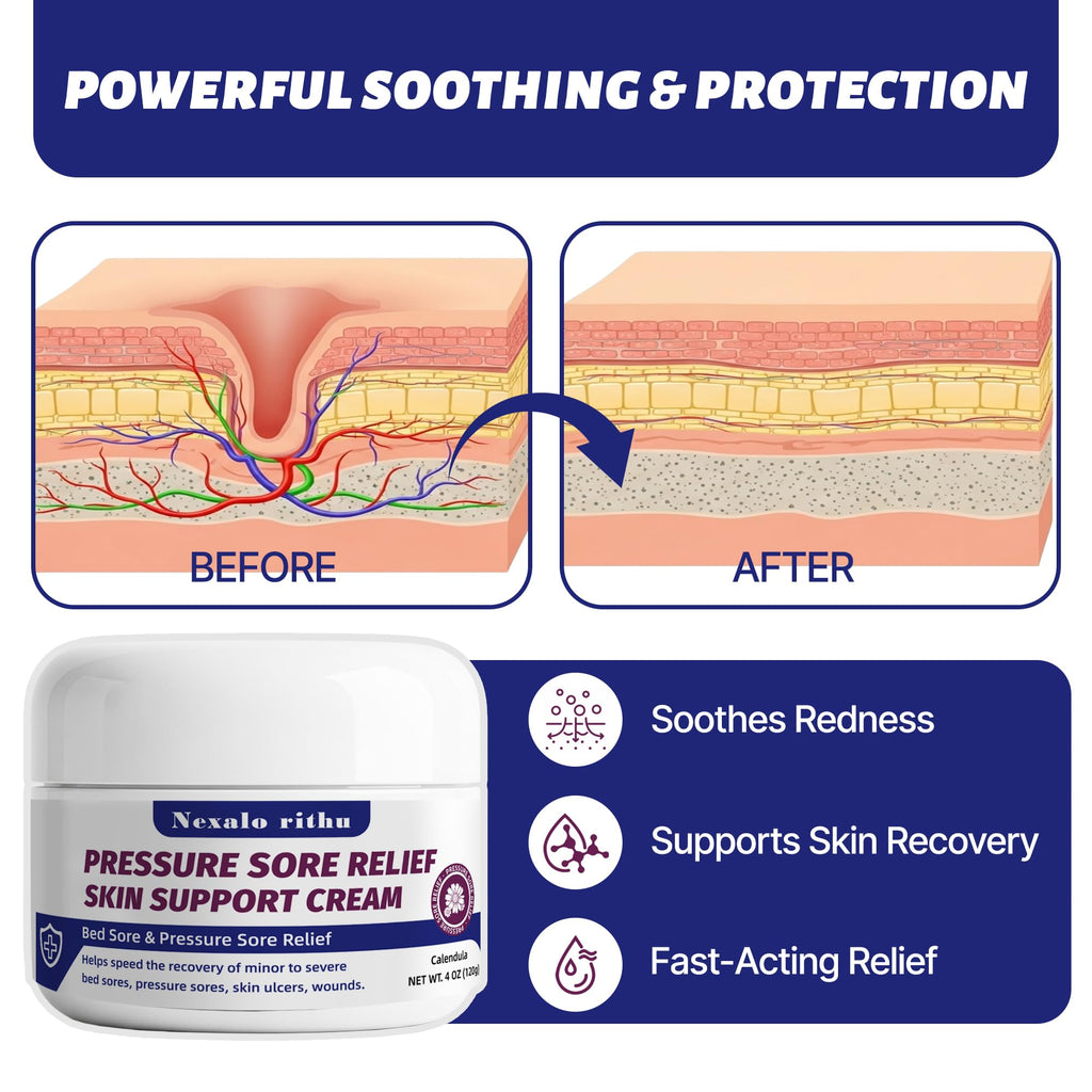 Calendula Aloe Vera Bed Sore Cream U388